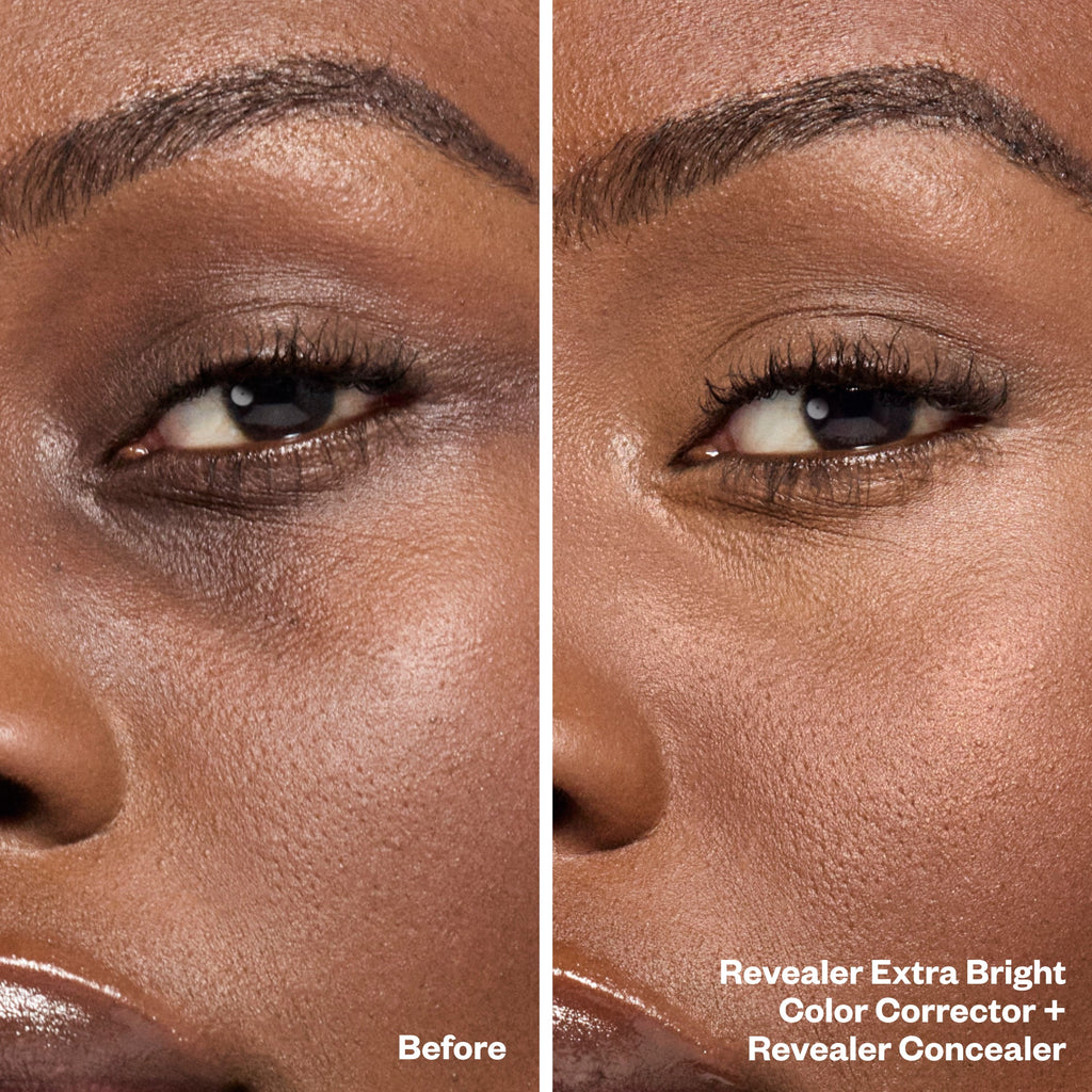 Before and After Bright Eyes Set